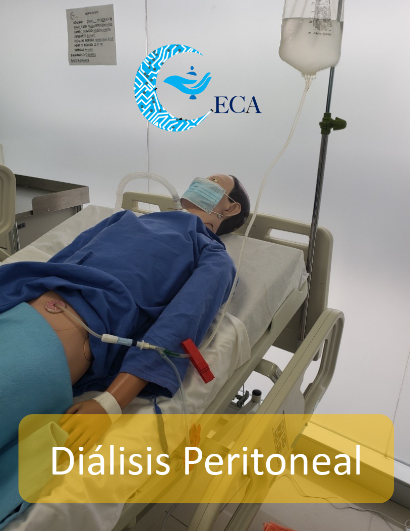 Instalación de la bolsa de diálisis peritoneal